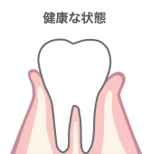 健康な状態