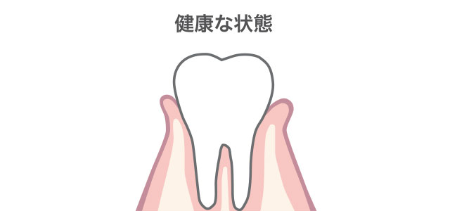 健康な状態